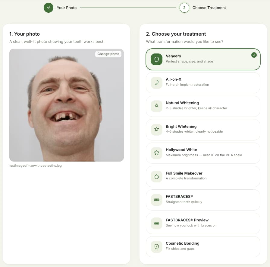 The Consult Engine studio: a patient photo uploaded on the left, the dental treatment catalogue open on the right with Veneers selected